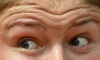 Mata Bisa Jadi Tanda Sakit Jantung, Bahkan Kematian