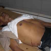 Bus vs Shogun, 1 Tewas