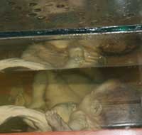 Janin Awetan Korban Agent Orange di Ho Chi Minh