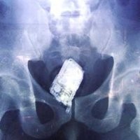 Waduh! 7 Napi Sembunyikan 30 Ponsel di Usus