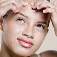 Wow, Kondom Bisa Obati Jerawat!