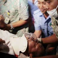 Korban Alami Patah Tulang Karena Tak Pakai Sabuk Pengaman 