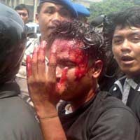 Mabes Polri Bantah Kecolongan Bentrokan FPI dan AKKBB