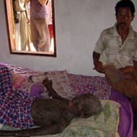 Penyakit Aneh Warga Bangkalan Diduga Virus Steven Syndrome