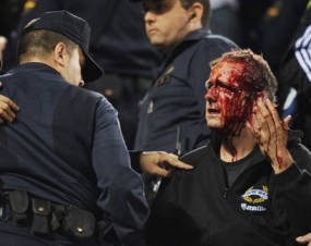 Atletico Yakin Bisa Main di Kandang