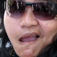 Penderita & Alumni Wajah Petot Bersatu