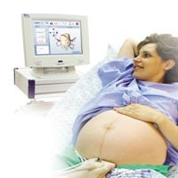 Melahirkan Normal Atau Operasi? Tanya Komputer!