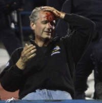 UEFA Korting Sanksi Atletico