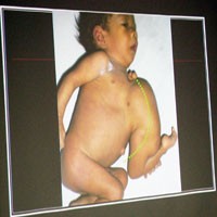 Gelar Gladi Kotor, Tim Dokter Siap Operasi Yovansa