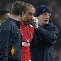 Silvestre Diragukan Tampil Lawan MU