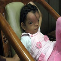 Ayah Pukul Kepala Ikan Lele, Cindy Alami Cacat Wajah