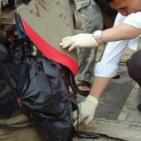 Korban Bertubuh Gempal, Dubur Normal