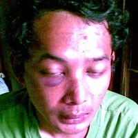 Penanganan Kasus Anak Jenderal Hartono Terkesan Hati-hati