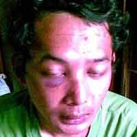 Tersangka Penganiayaan, Anak Jenderal Hartono Diperiksa Polisi