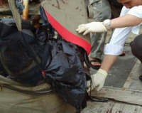  Korban Punya Tonjolan di Lengan Kirinya