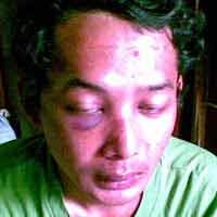 Anak Jenderal Hartono & Korban Damai, Polisi Jalan Terus