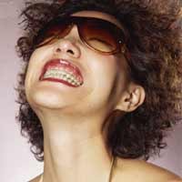 Makanan Nyangkut di Kawat Gigi? Ini Tipsnya!