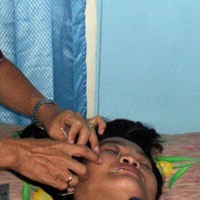 Sembuhkan Wajah Petot dengan Tehnik Akupuntur