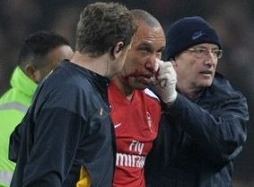 Duo Bek Arsenal Absen 3 Minggu 