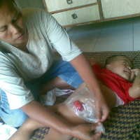 Tak Miliki Anus, Rivan BAB Lewat Usus