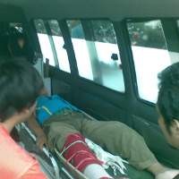 Nekat Panjat Pagar 5 Meter, Kaki Kanan Dede Patah