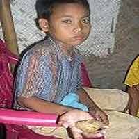 Muhtashor Derita Perut Kembung Selama 20 Tahun