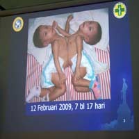 Tissue Expander Tertahan di Bandara Cengkareng