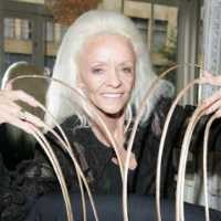 Rekor Kuku Terpanjang di Dunia Putus Akibat Kecelakaan