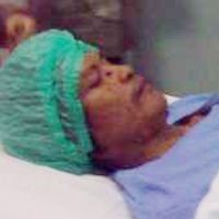 Kondisi Membaik, Dede Manusia Pohon Bisa Pulang 2 Hari Lagi