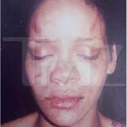 Foto Rihanna Babak-Belur Beredar, Polisi Buka Mulut