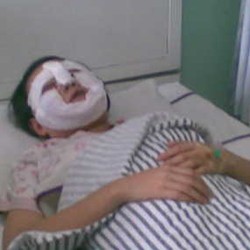 Rujuk Ditolak, Mantan Suami Siram Novi dengan Air Keras