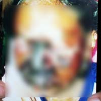 Berawal dari Ngilu, Wajah Nita Malah Hancur