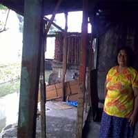 Anik Butuh Uluran Tangan Penderma