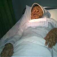 RSHS Bentuk Tim Dokter Tangani Yani