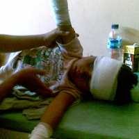 Angkot Terbakar, Tiga Orang Alami Luka Bakar Parah 