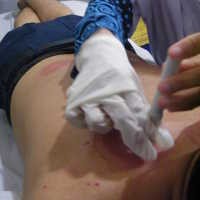 Lain Darah Lain Penyakit