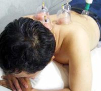 Usir Berbagai Penyakit dengan Bekam