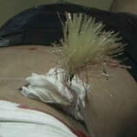 Dua Sejoli Kencan, Sang Gadis Terkena Anak Panah Misterius