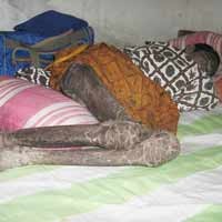 Terserang Penyakit Paru-paru, Tubuh Adi Menghitam dan Kering