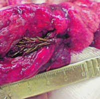 Ranting Cemara Tumbuh di Paru-paru Manusia?