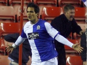 Santa Cruz Siap Tinggalkan Blackburn