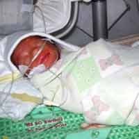 Bayi Kembar 3 Lahir di Kota Tahu