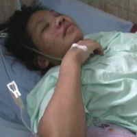 Tulang Belakang Patah dan Remuk