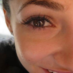 Hati-hati! Kolesterol Tinggi Bisa Bikin Buta 