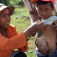 Ekonomi Pas-pasan, Nurul Hidup dengan Usus Keluar