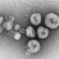 Awas! Ada Virus Baru yang Mematikan