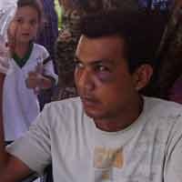 Diduga Dianiaya Oknum TNI AL, Tentara Gadungan Babak Belur