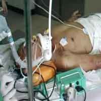 Infeksi Paru-paru, Mayor Dedi Kritis