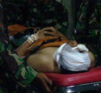 Tiba di RSHS, Letda Agus Langsung Jalani CT Scan