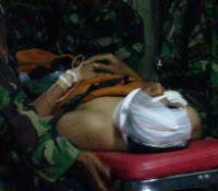 Kondisi Letda Agus Mulai Membaik